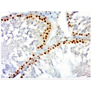 Anti-TNF alpha(1F6) antibody-腫瘤壞死因子-α單克隆抗體