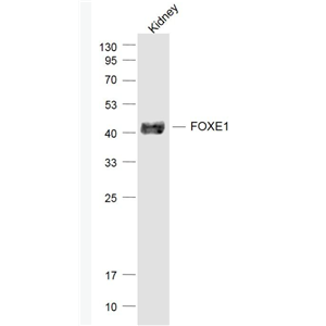 Anti-FOXE1 antibody-甲状腺转录因子-2抗体,FOXE1