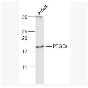 Anti-PTGEs/Prostaglandin E Synthase antibody-前列腺素E合成酶抗体