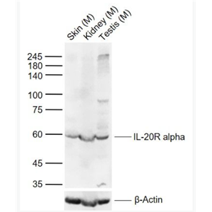 Anti-IL-20R alpha antibody-白介素20受体α链抗体