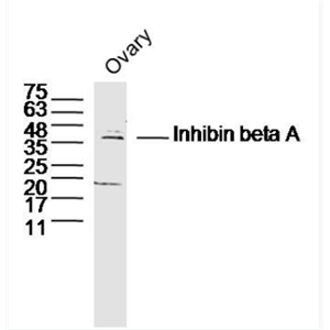 Anti-Inhibin beta A antibody-抑制素βA/Inhibin βA抗体