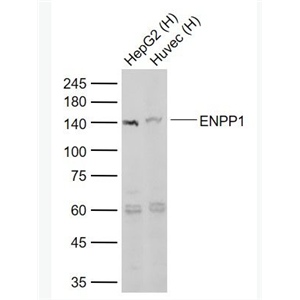 Anti-ENPP1 antibody-核苷酸内焦磷酸酶/磷酸二酯酶1抗体