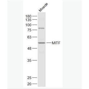 Anti-MITF antibody-微小细胞血症相关转录因子抗体