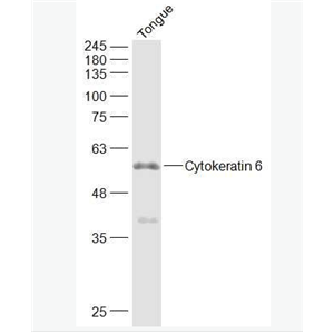 Anti-Cytokeratin 6 antibody-细胞角蛋白6抗体,Cytokeratin 6