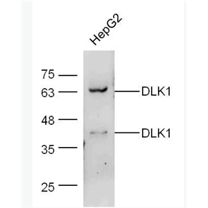 Anti-DLK1 antibody-穿膜蛋白DLK1抗体