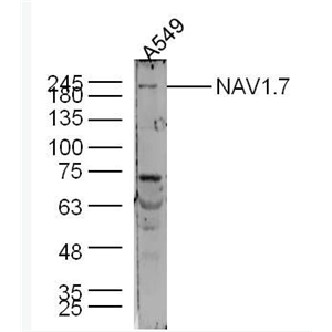Anti-NAV1.7 antibody-电压开启的钠离子通道SCN9A抗体
