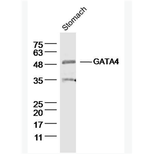 Anti-GATA4  antibody-GATA结合蛋白4抗体,GATA4