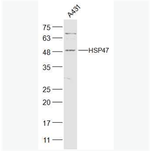 Anti-HSP47 antibody-热休克蛋白-47抗体