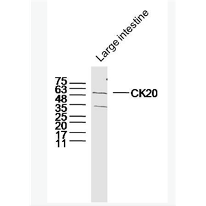 Anti-CK20 antibody-细胞角蛋白20抗体