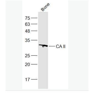 Anti-CA II antibody-碳酸酐酶2抗体