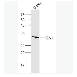 Anti-CA II antibody-碳酸酐酶2抗体,CA II