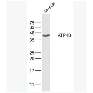 Anti-ATP4B antibody-氢钾ATP酶通道蛋白抗体