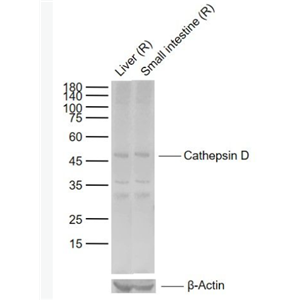 Anti-Cathepsin D antibody-组织蛋白酶D轻链抗体,Cathepsin D
