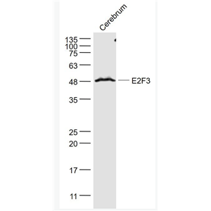 Anti-E2F3 antibody-转录因子E2F-3抗体