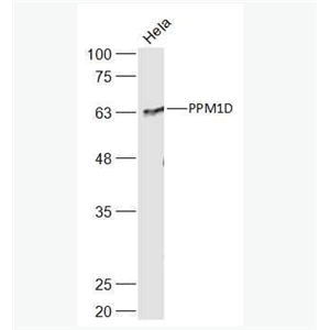 Anti-PPM1D antibody-原癌基因WIP1抗体