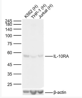 Anti-IL-10RA antibody-白细胞介素-10受体a抗体,IL-10RA