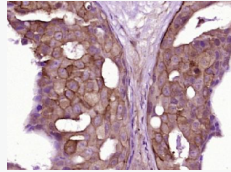 Anti-KIR2DL4 antibody-NK細胞抑制性受體2DL4（CD158D）抗體,KIR2DL4