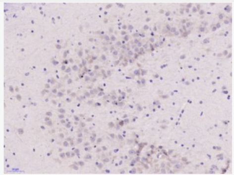 Anti-IL17E antibody-白介素-17E/白介素25抗體,IL17E