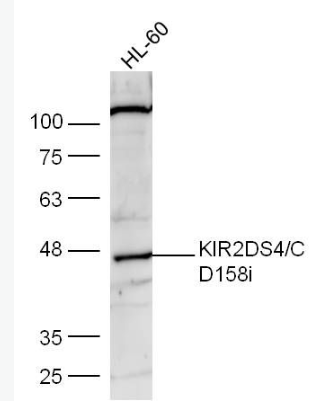 Anti-KIR2DS4/CD158i antibody-NK细胞抑制性受体2DS4抗体,KIR2DS4/CD158i