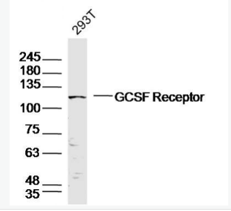 Anti-GCSF Receptor antibody-粒细胞-巨噬细胞集落刺激因子3受体抗体,GCSF Receptor