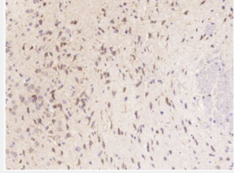 Anti-CXCL5 antibody-上皮中性粒细胞活化肽78抗体,CXCL5