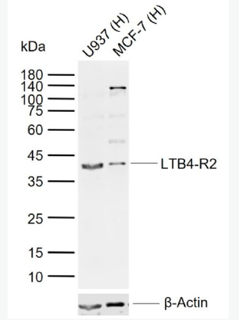 Anti-LTB4-R2 antibody-白三烯B4受体2抗体,LTB4-R2