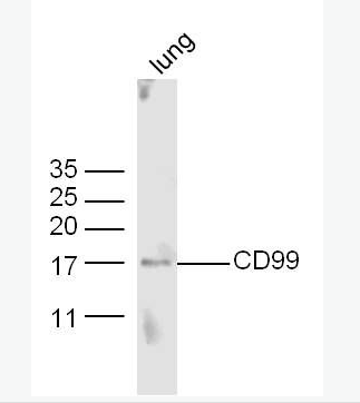 Anti-CD99 antibody-CD99抗体,CD99
