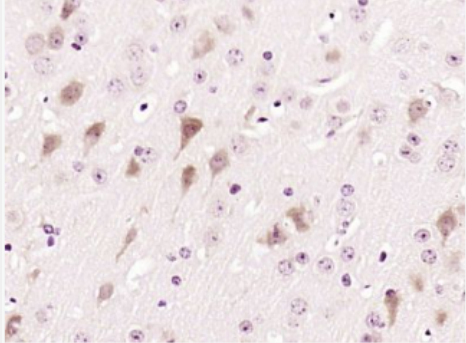 Anti-CD155 antibody-脊髓灰质炎病毒受体抗体,CD155