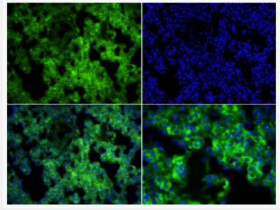 Anti-MARCO antibody-巨噬细胞清道夫受体抗体,MARCO