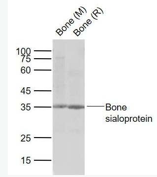 Anti-Bone sialoprotein antibody-骨涎蛋白抗体,Bone sialoprotein