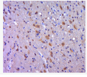 Anti-AIMP2 antibody-AIMP2抗體,AIMP2