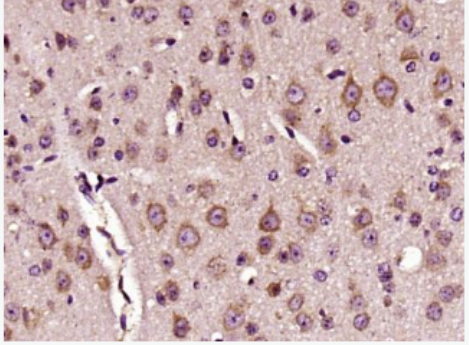 Anti-DKK3 antibody-抑癌蛋白DKK3抗體,DKK3