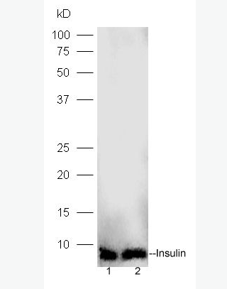 Anti-Insulin antibody-胰岛素抗体,Insulin