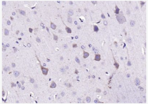 Anti-LPA3 antibody-溶血磷脂酸受體蛋白3/EDG7抗體,LPA3