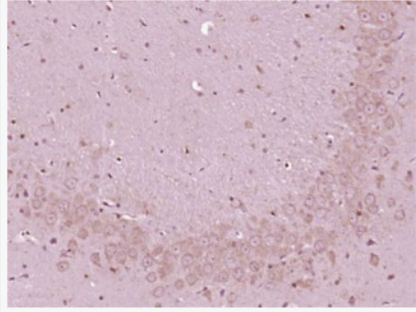 Anti-Urocortin 3 antibody-尿皮質(zhì)素UCN3抗體,Urocortin 3