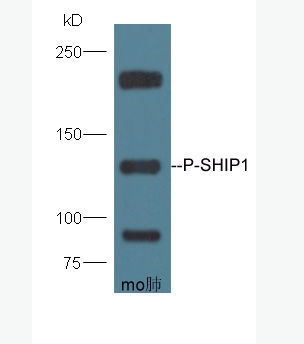Anti-Phospho-SHIP1 (Tyr1020) antibody-磷酸化SH2结构含磷酸肌醇SHIP1抗体,Phospho-SHIP1 (Tyr1020)