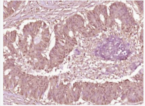 Anti-Phospho-cdc25A (Ser178) antibody-磷酸化细胞分裂周期蛋白25抗体,Phospho-cdc25A (Ser178)