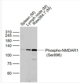 Anti-Phospho-NMDAR1 (Ser896) antibody-磷酸化离子型谷氨酸受体1抗体,Phospho-NMDAR1 (Ser896)