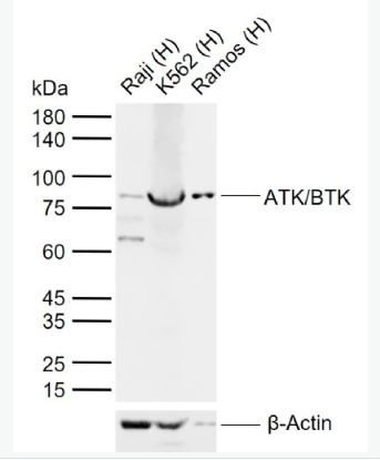 Anti-ATK/BTK antibody-酪氨酸蛋白激酶BTK抗体,ATK/BTK