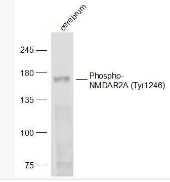 Anti-Phospho-NMDAR2A (Tyr1246) antibody-磷酸化谷氨酸受体2A抗体,Phospho-NMDAR2A (Tyr1246)