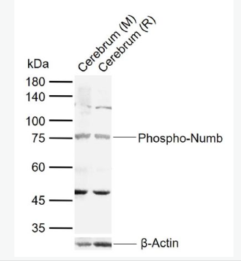 Anti-Phospho-Numb (Ser276) antibody-磷酸化膜相关蛋白Numb抗体,Phospho-Numb (Ser276)