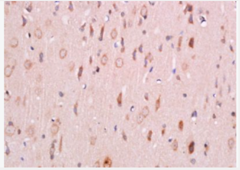 Anti-Phospho-PDK1 (Ser241) antibody-磷酸化3磷酸肌醇依赖性蛋白激酶1,Phospho-PDK1 (Ser241)