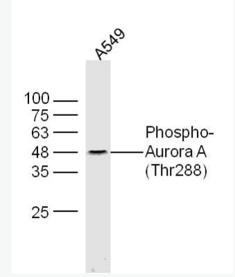 Anti-Phospho-Aurora A (Thr288) antibody-磷酸化有丝分裂激酶A抗体,Phospho-Aurora A (Thr288)