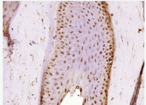 Anti-Phospho-Rb (Ser807 + Ser811) antibody-磷酸化视网膜母细胞瘤相关蛋白1抗体,Phospho-Rb (Ser807 + Ser811)