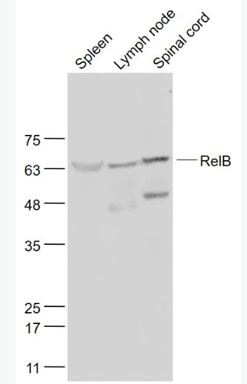 Anti-RelB antibody-核转录因子NFKB-RelB蛋白抗体,RelB