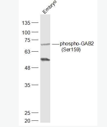 Anti-phospho-GAB2 (Ser159) antibody-磷酸化接头蛋白Gab2抗体,phospho-GAB2 (Ser159)
