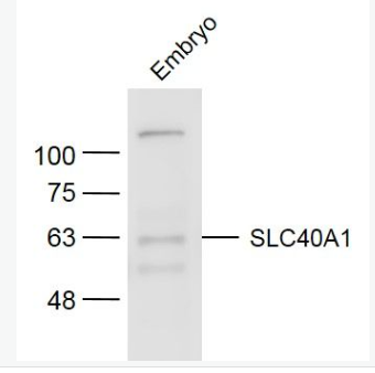 Anti-SLC40A1 antibody-细胞膜铁转运蛋白FP1抗体,SLC40A1