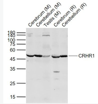 Anti-CRHR1 antibody-促肾上腺皮质释放激素受体1抗体,CRHR1