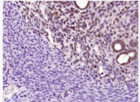 Anti-CPSF4 antibody-剪切和多聚腺苷酸化特异性因子4抗体,CPSF4