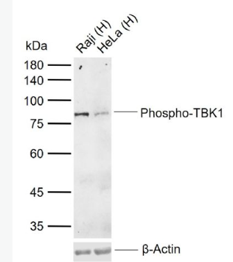 Anti-Phospho-TBK1 (Ser172) antibody-磷酸化NF-κB活化激酶抗体,Phospho-TBK1 (Ser172)